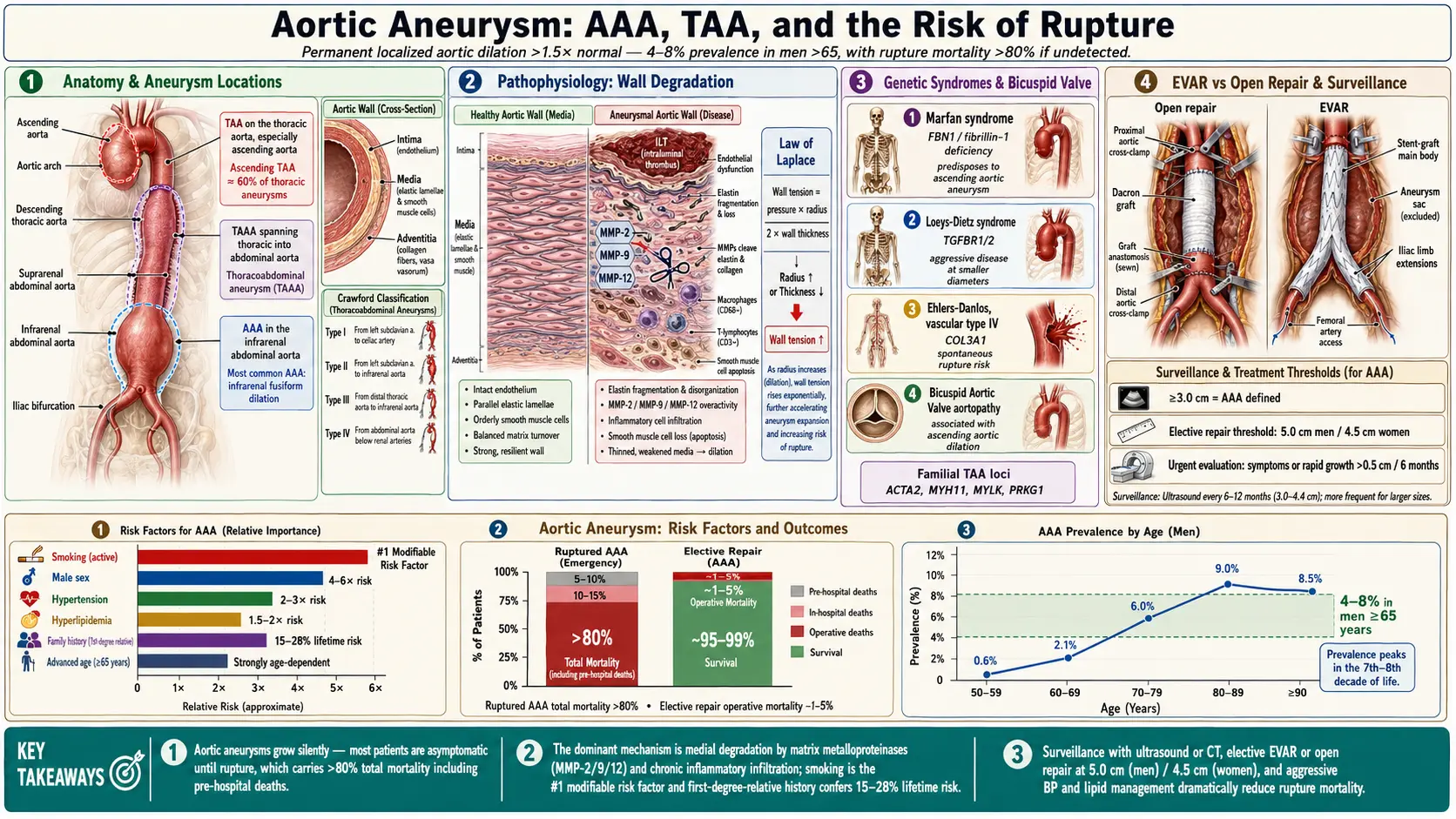 Aortic Aneurysm — scientific infographic poster