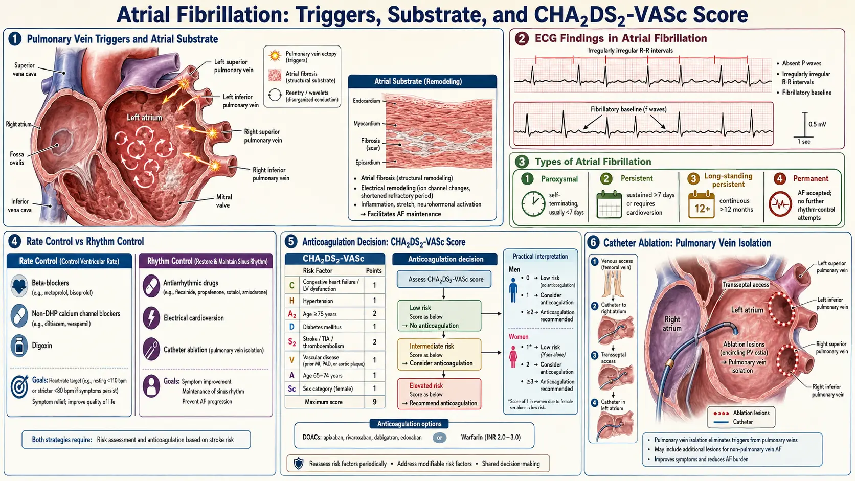 Atrial Fibrillation — scientific infographic poster
