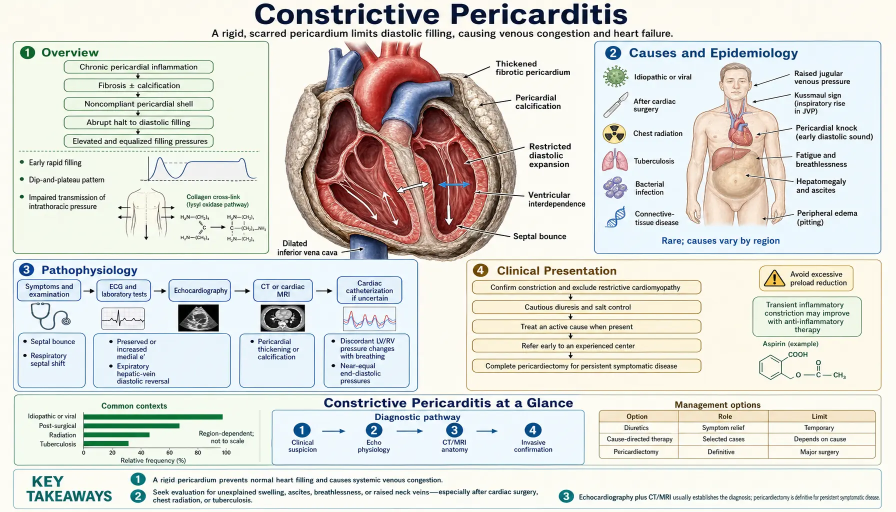 Constrictive Pericarditis — scientific infographic poster