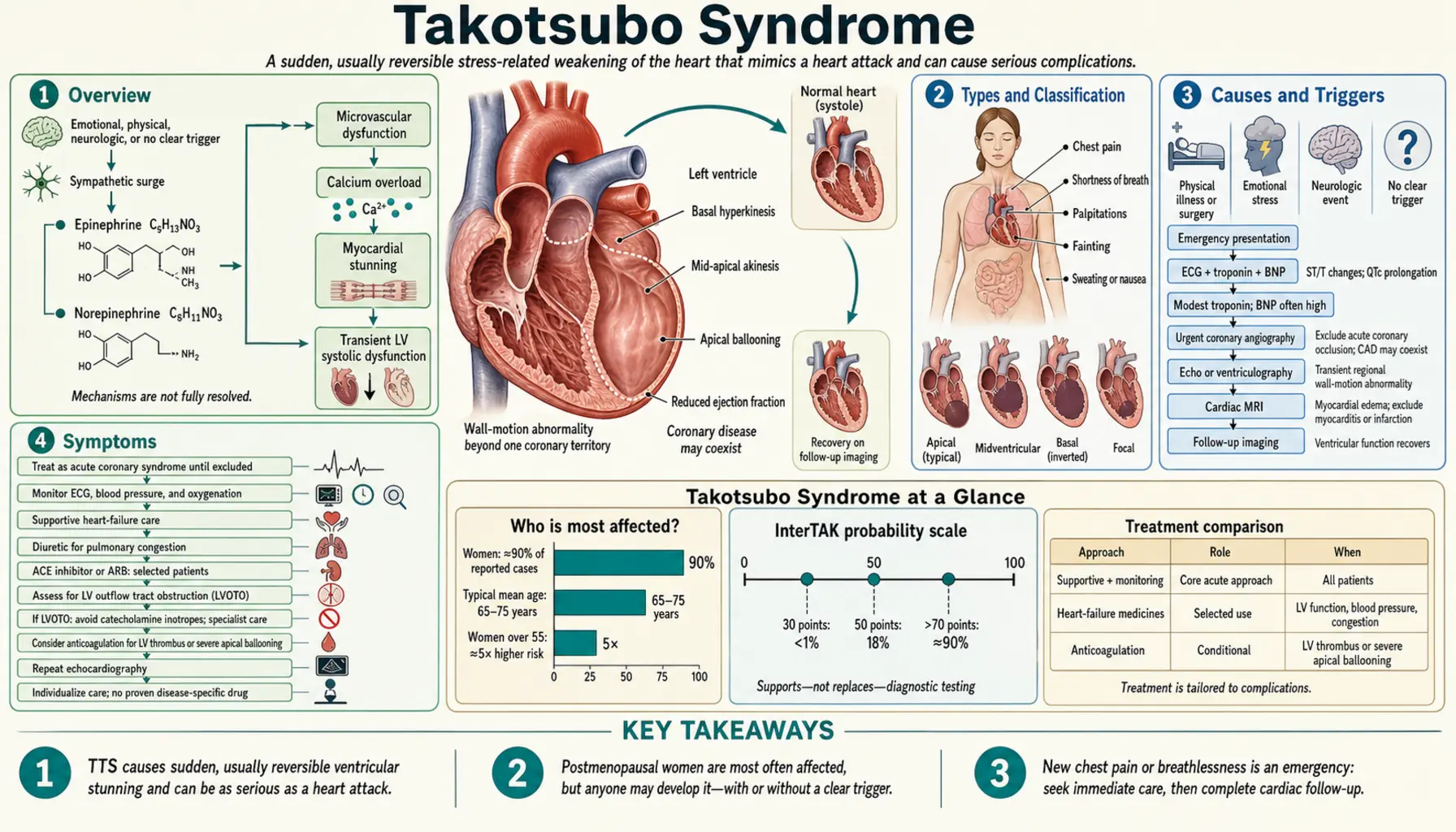 Takotsubo Syndrome — scientific infographic poster