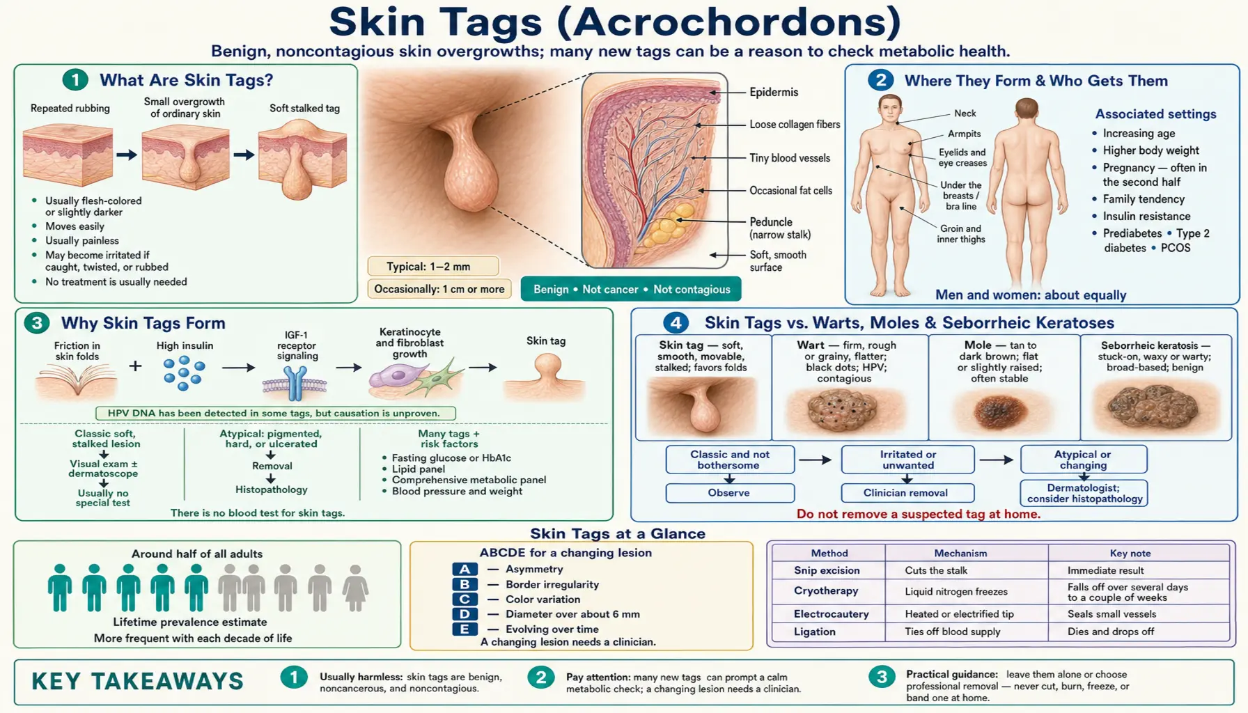 Skin Tags — scientific infographic poster