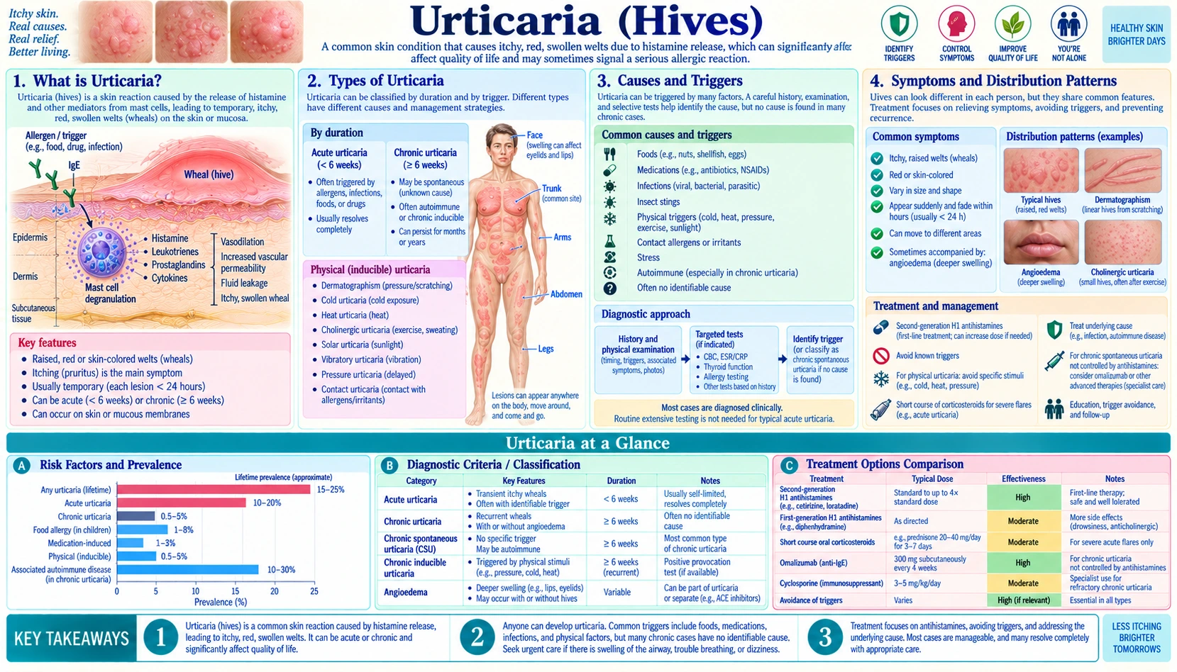 Urticaria — scientific infographic poster