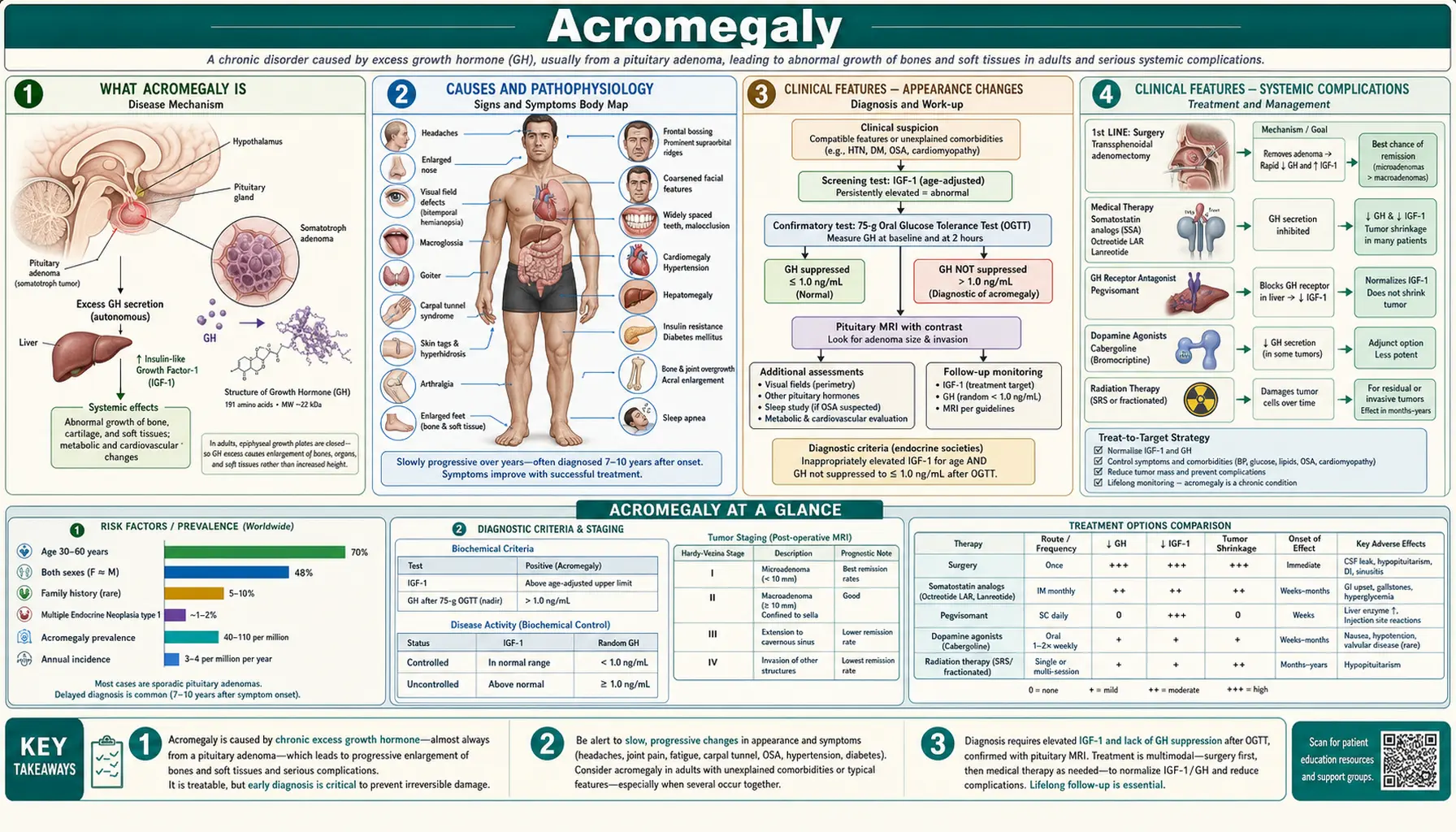 Acromegaly — scientific infographic poster