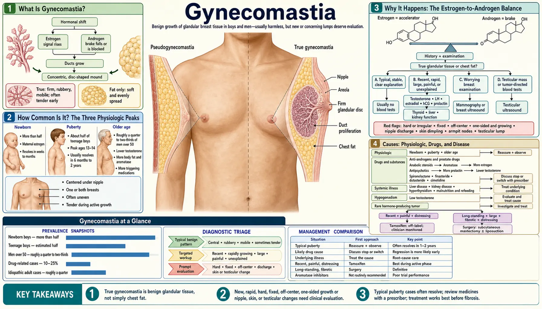 Gynecomastia — scientific infographic poster