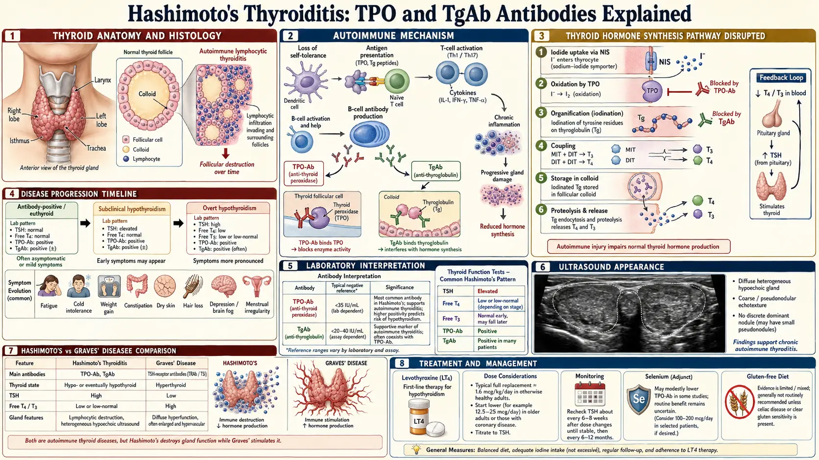 TPO and TgAb Antibodies Explained — scientific infographic poster