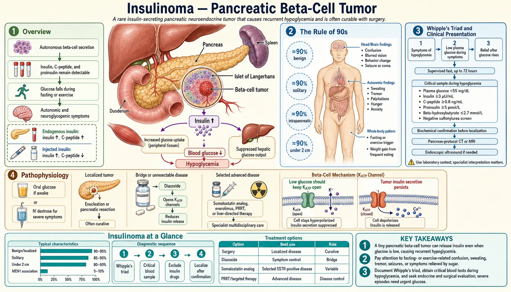 Insulinoma — scientific infographic poster