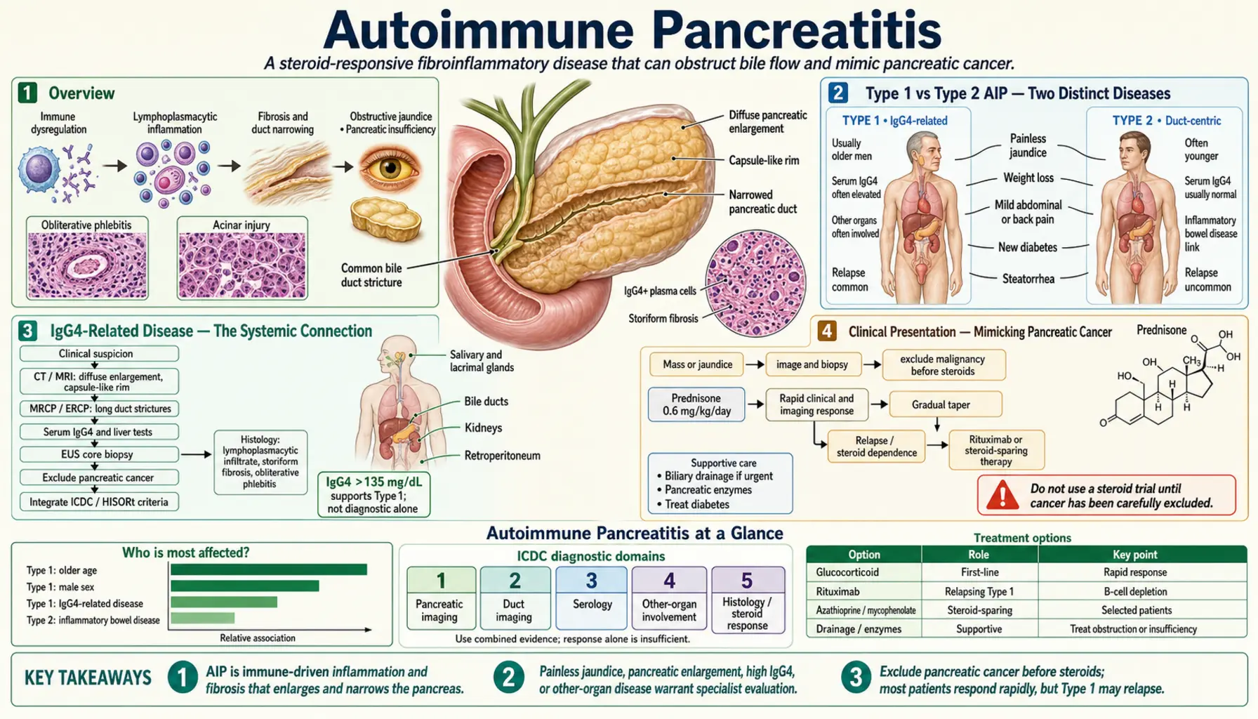 Autoimmune Pancreatitis — scientific infographic poster