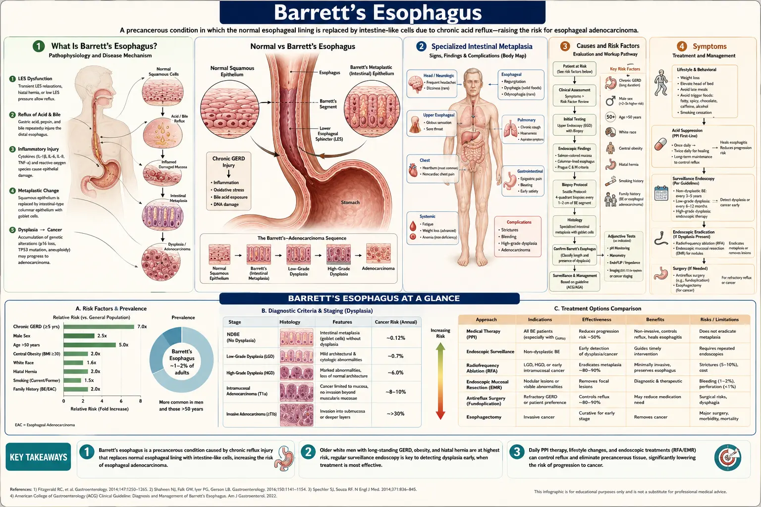 Barretts Esophagus — scientific infographic poster