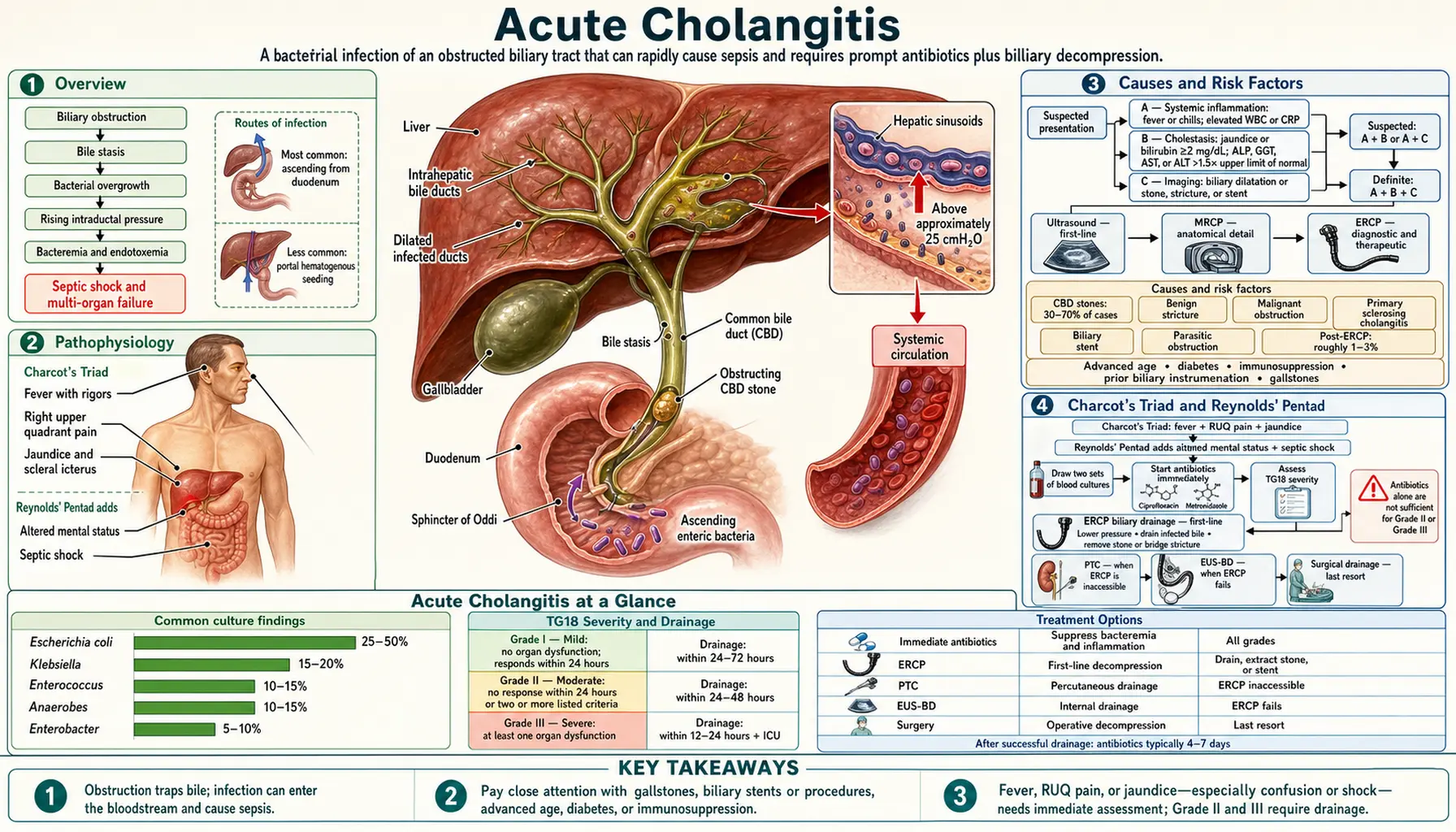 Cholangitis — scientific infographic poster