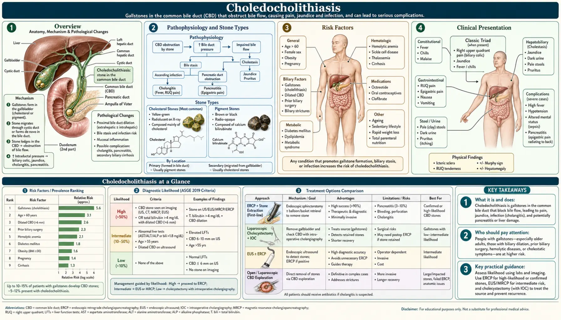 Choledocholithiasis — scientific infographic poster