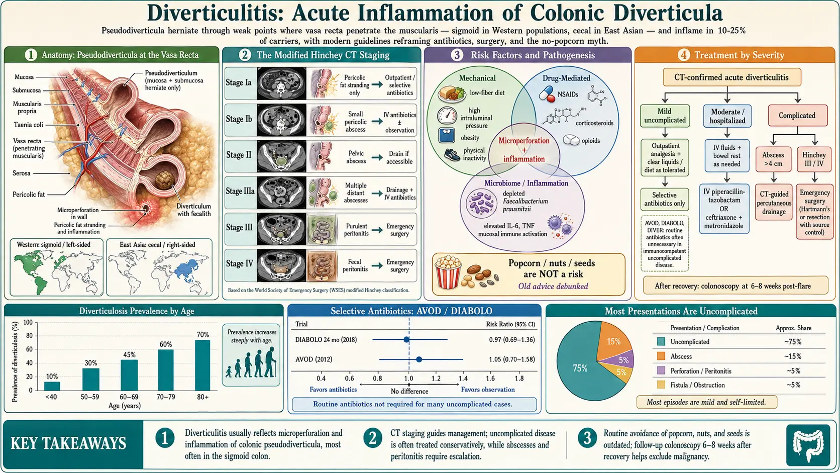 Diverticulitis — scientific infographic poster