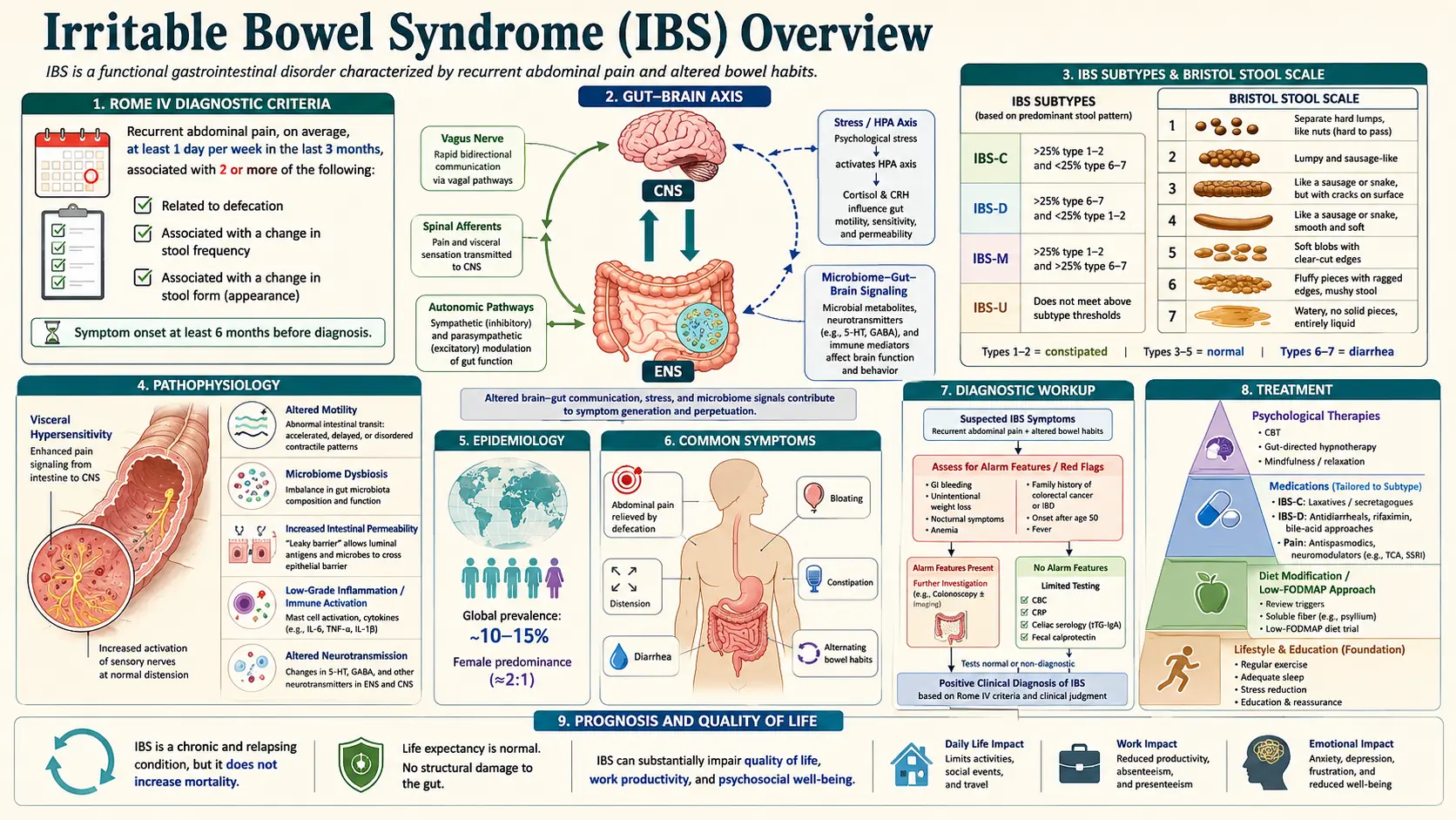 Irritable Bowel Syndrome — scientific infographic poster