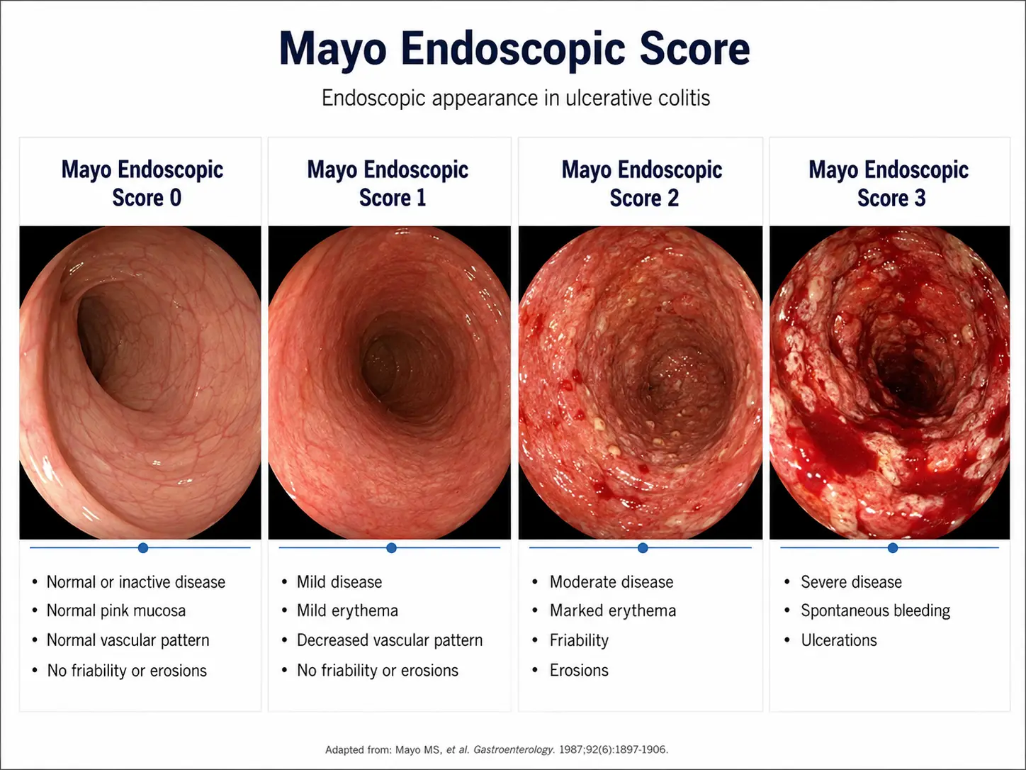 UC severity endoscopy
