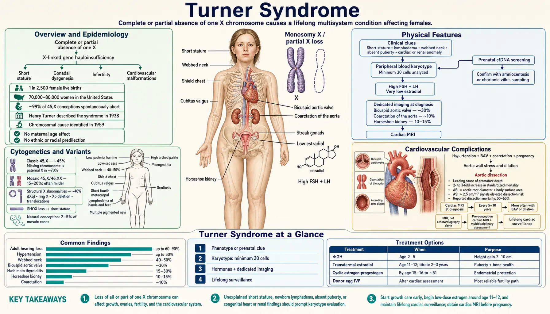 Turner Syndrome — scientific infographic poster
