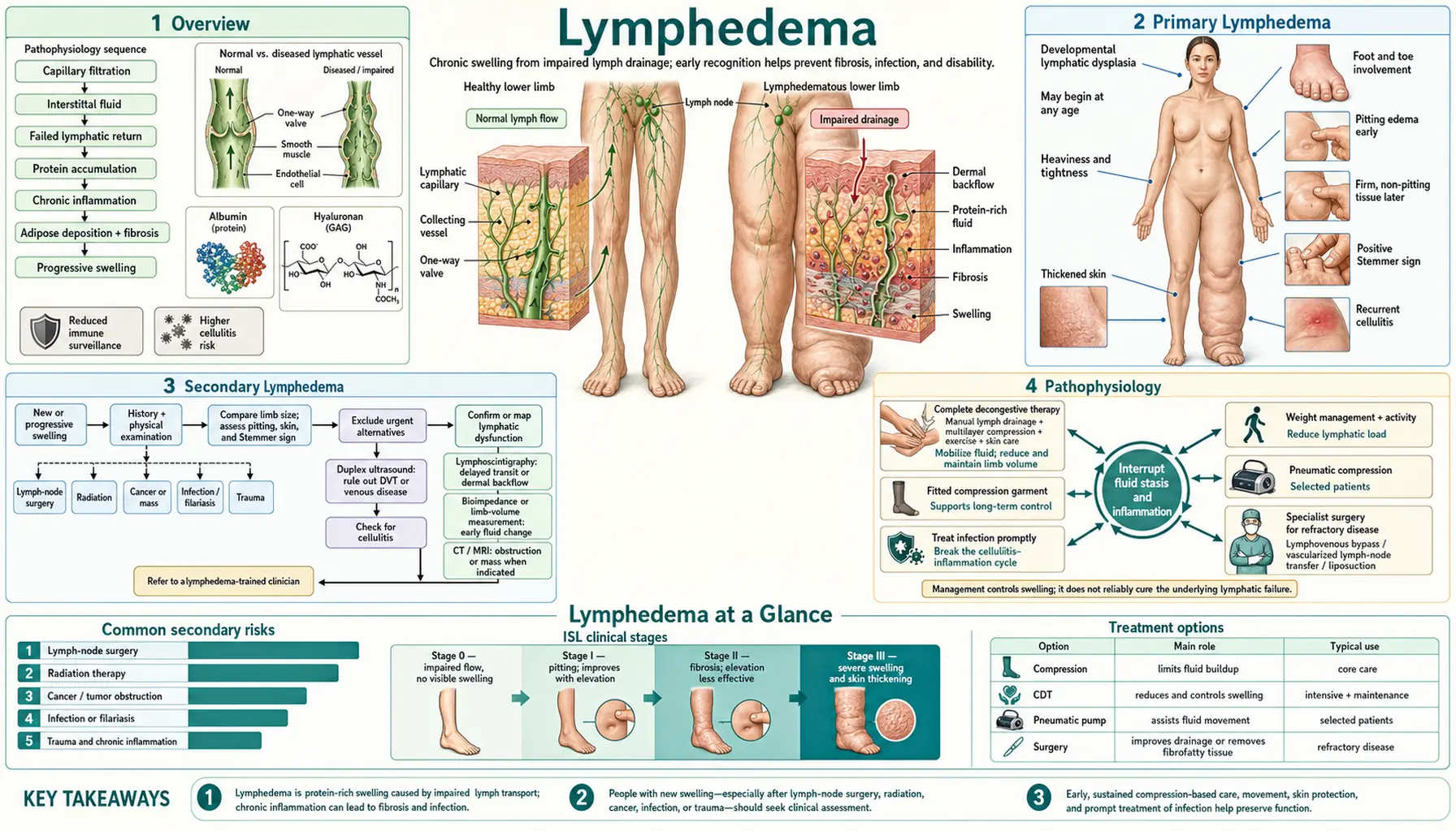 Lymphedema — scientific infographic poster