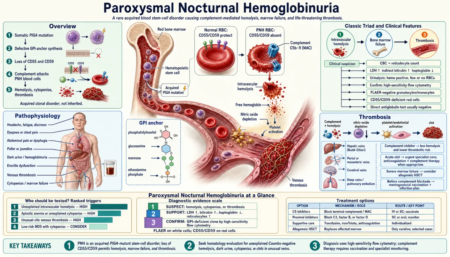 Paroxysmal Nocturnal Hemoglobinuria — scientific infographic poster