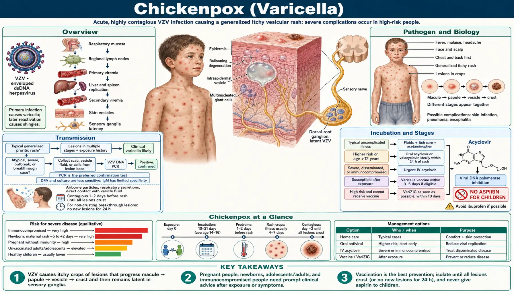 Chickenpox — scientific infographic poster