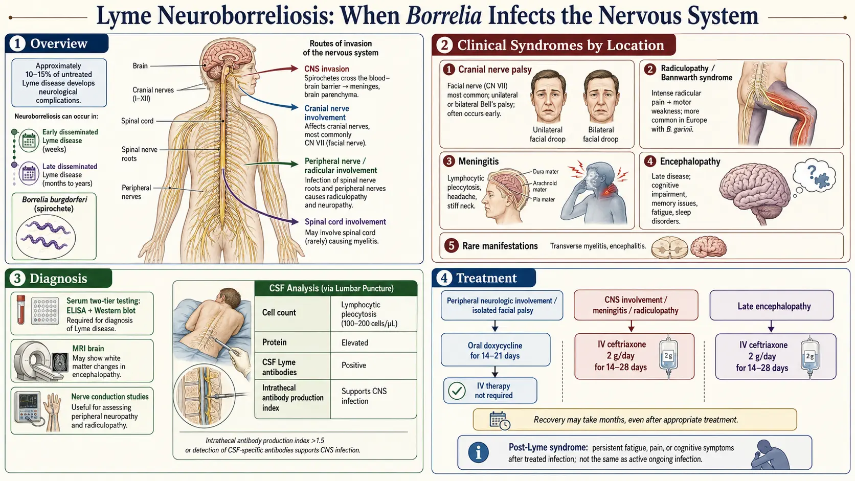 Lyme Neuroborreliosis — scientific infographic poster