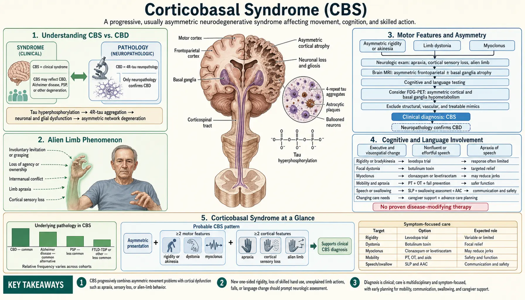 Corticobasal Syndrome — scientific infographic poster