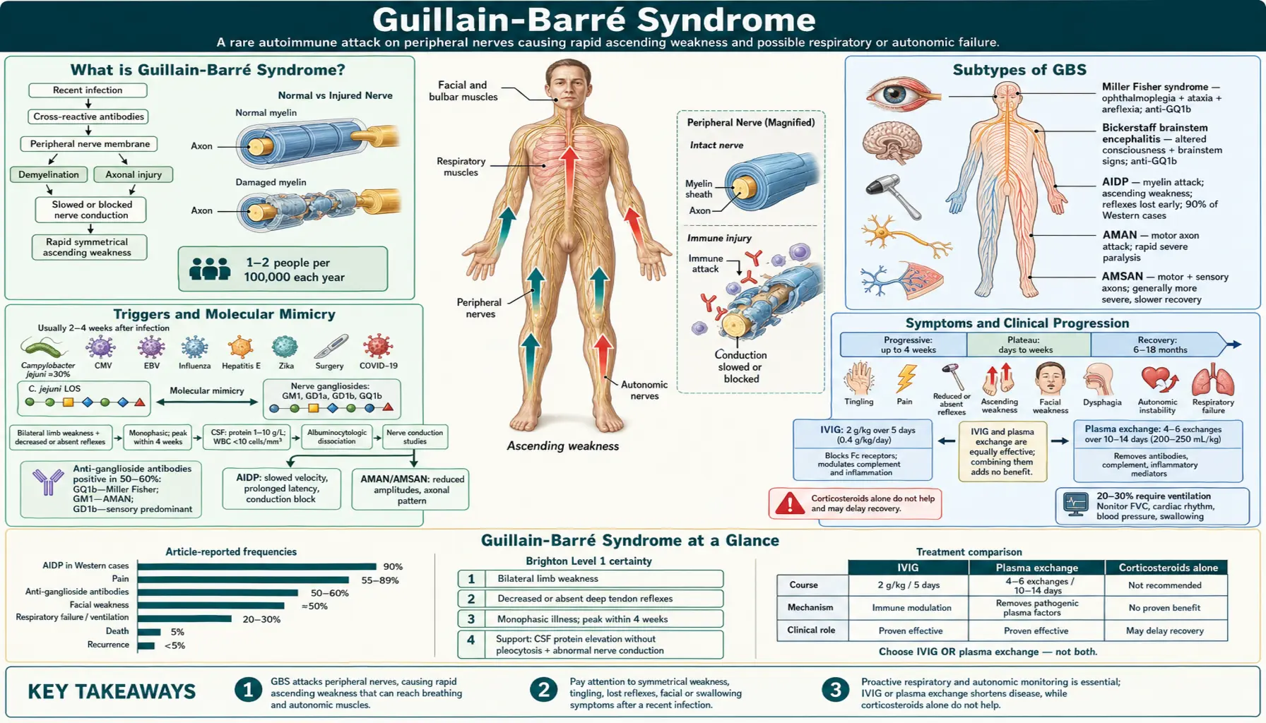 Guillain Barre Syndrome — scientific infographic poster