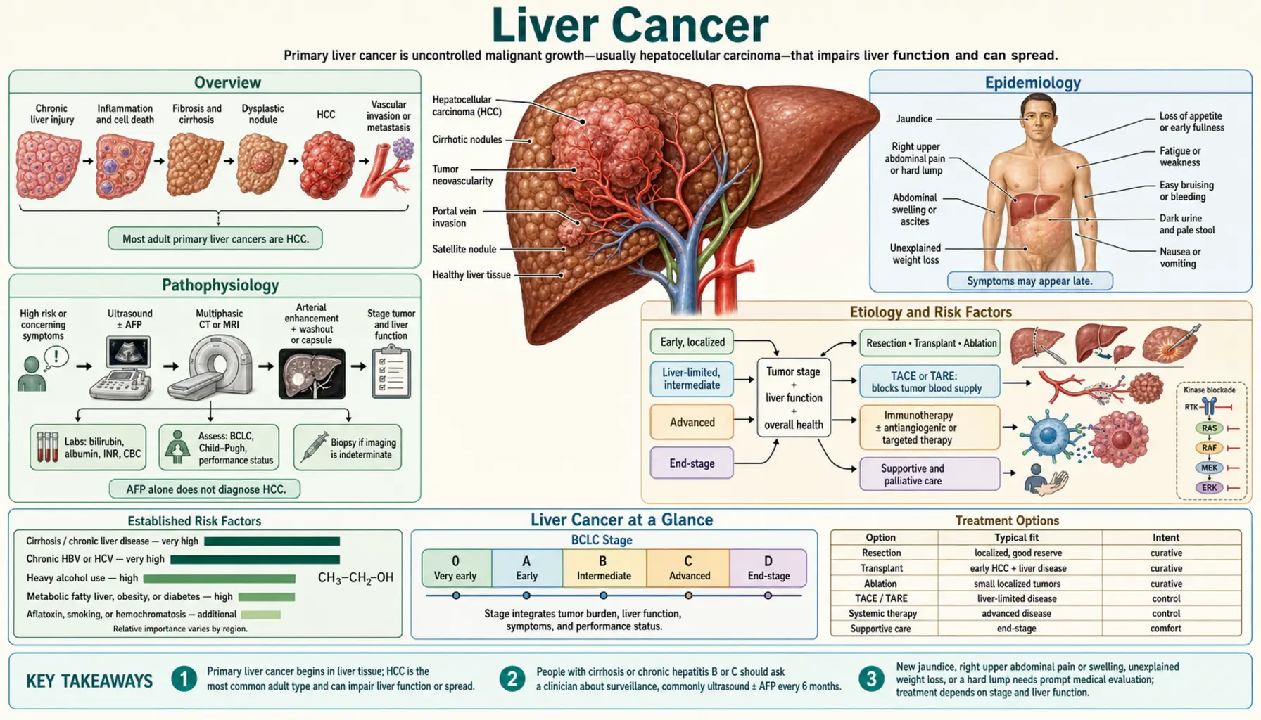 Liver Cancer — scientific infographic poster
