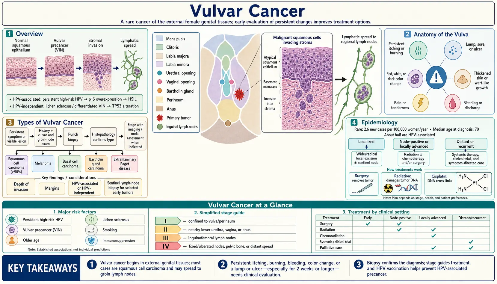 Vulvar Cancer — scientific infographic poster