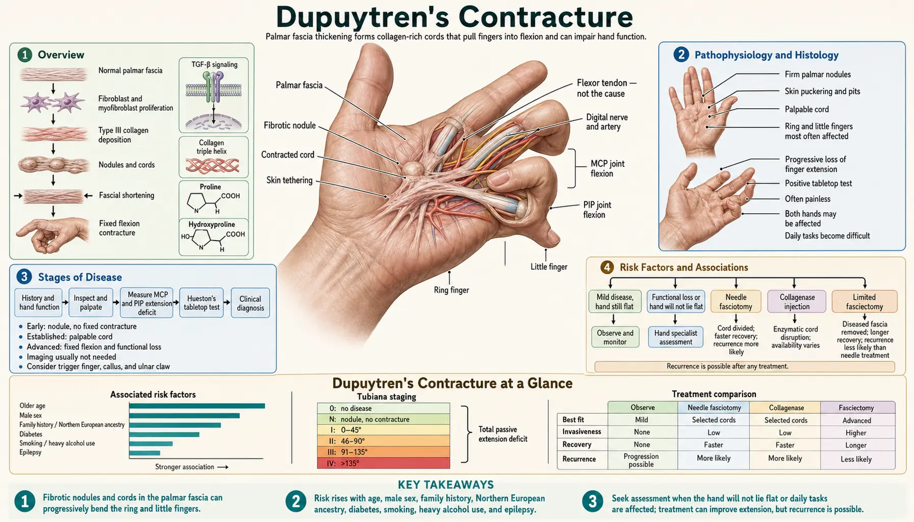 Dupuytrens Contracture — scientific infographic poster