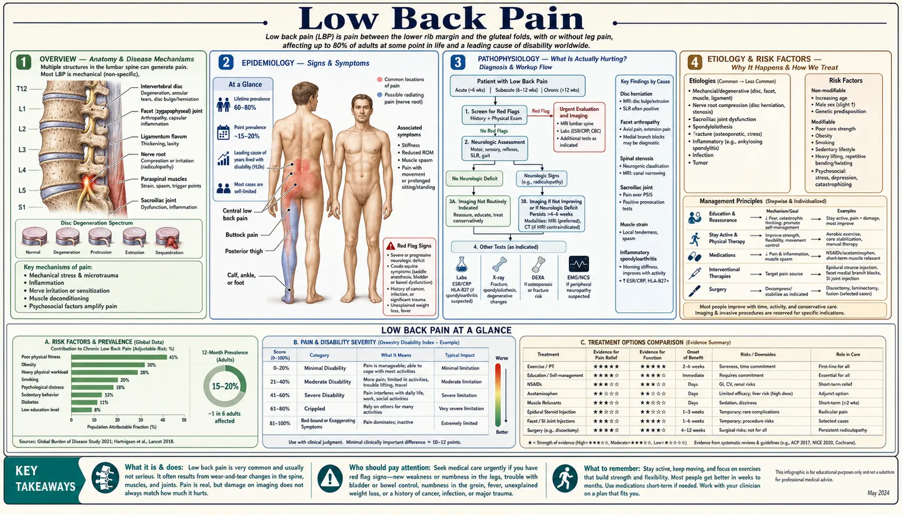 Low Back Pain — scientific infographic poster