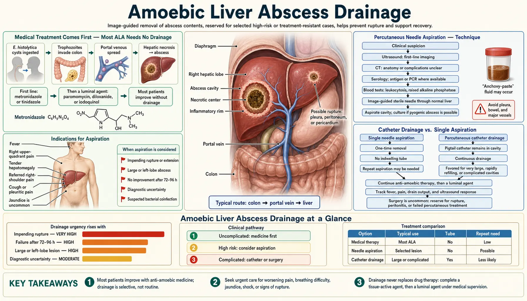 Liver Abscess Drainage — scientific infographic poster
