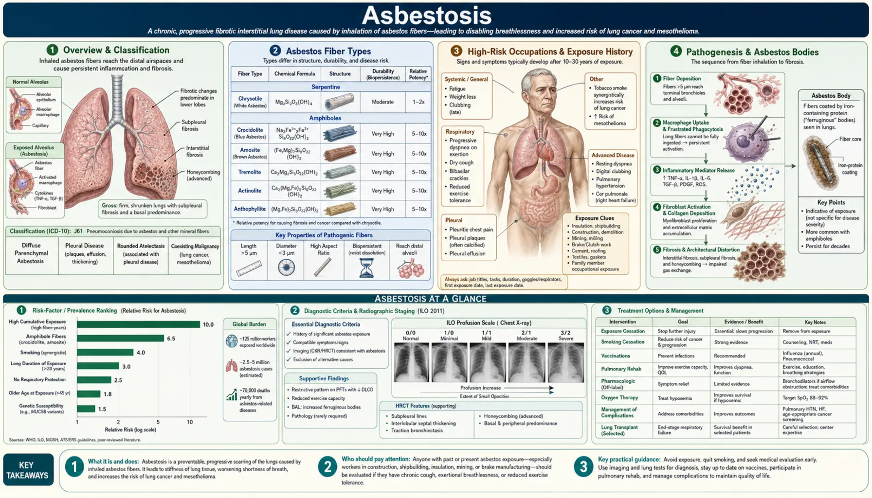 Asbestosis — scientific infographic poster