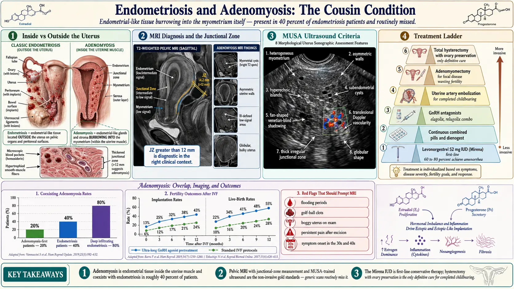 Adenomyosis Overlap — scientific infographic poster