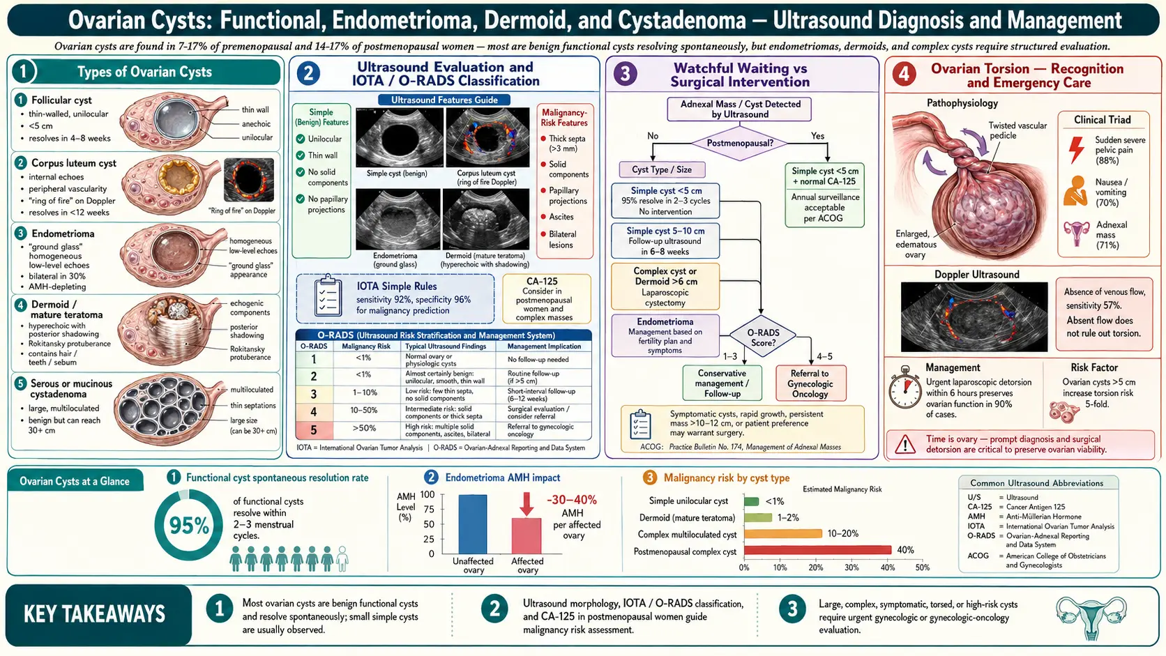 Ovarian Cysts — scientific infographic poster