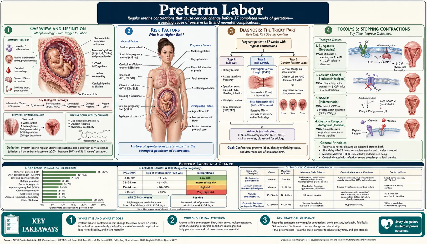 Preterm Labor — scientific infographic poster