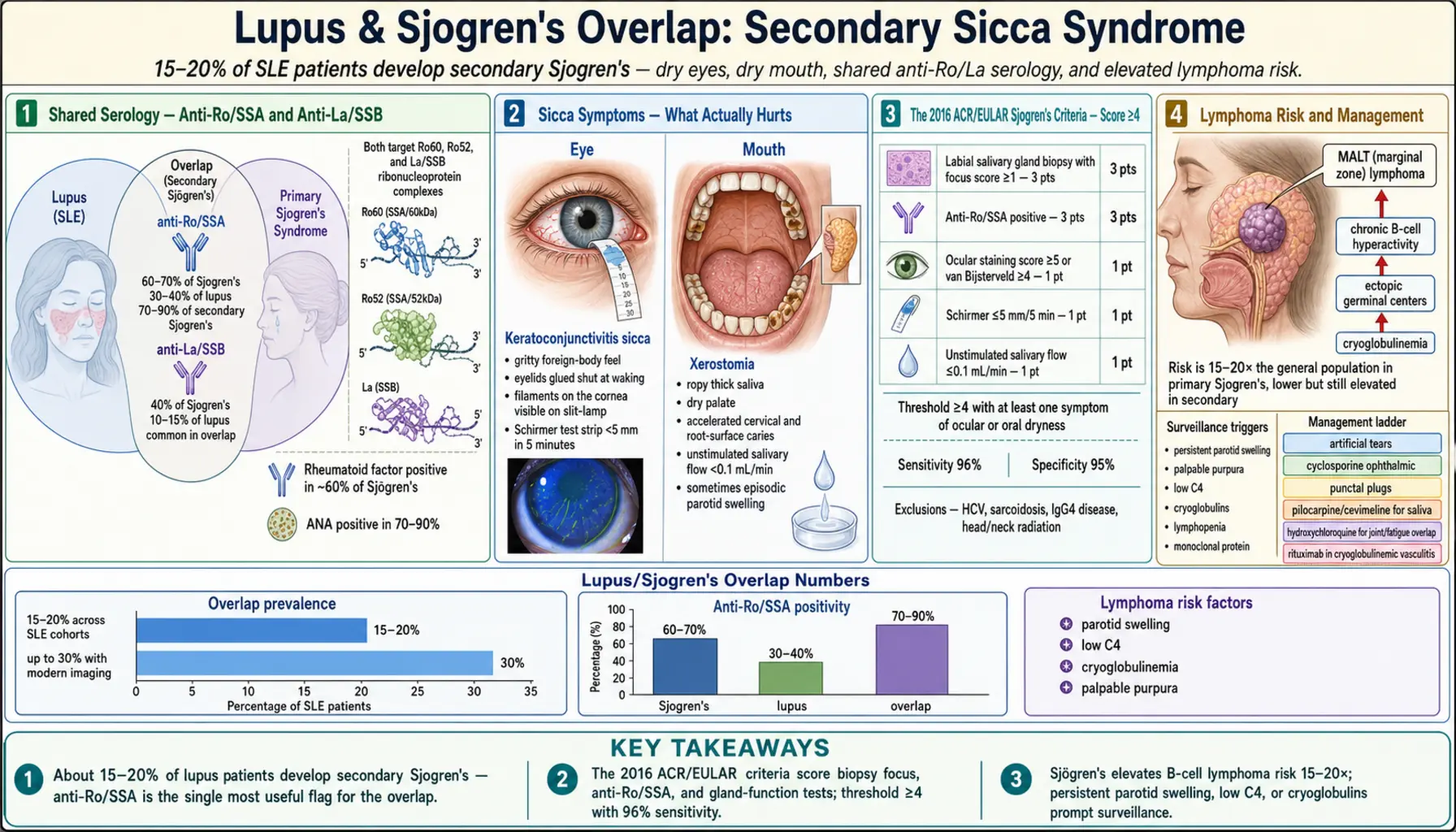 Lupus Sjogrens Overlap and Secondary Sjogrens — scientific infographic poster