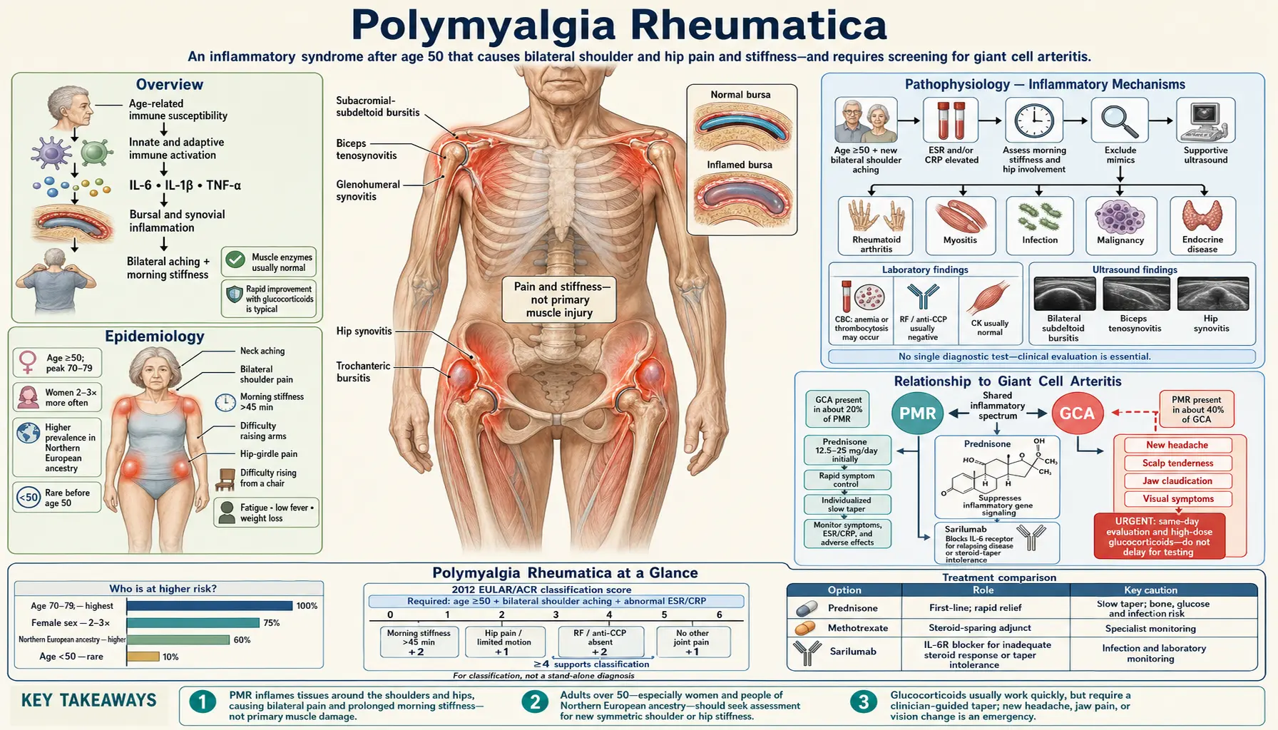 Polymyalgia Rheumatica — scientific infographic poster