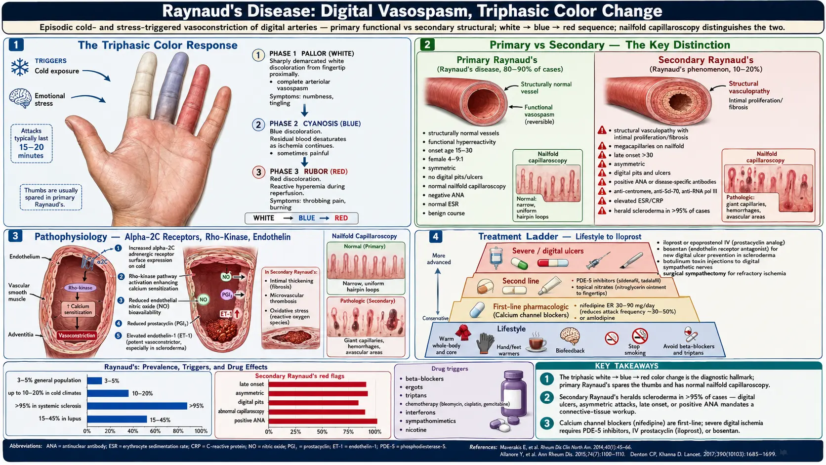 Raynauds Disease — scientific infographic poster