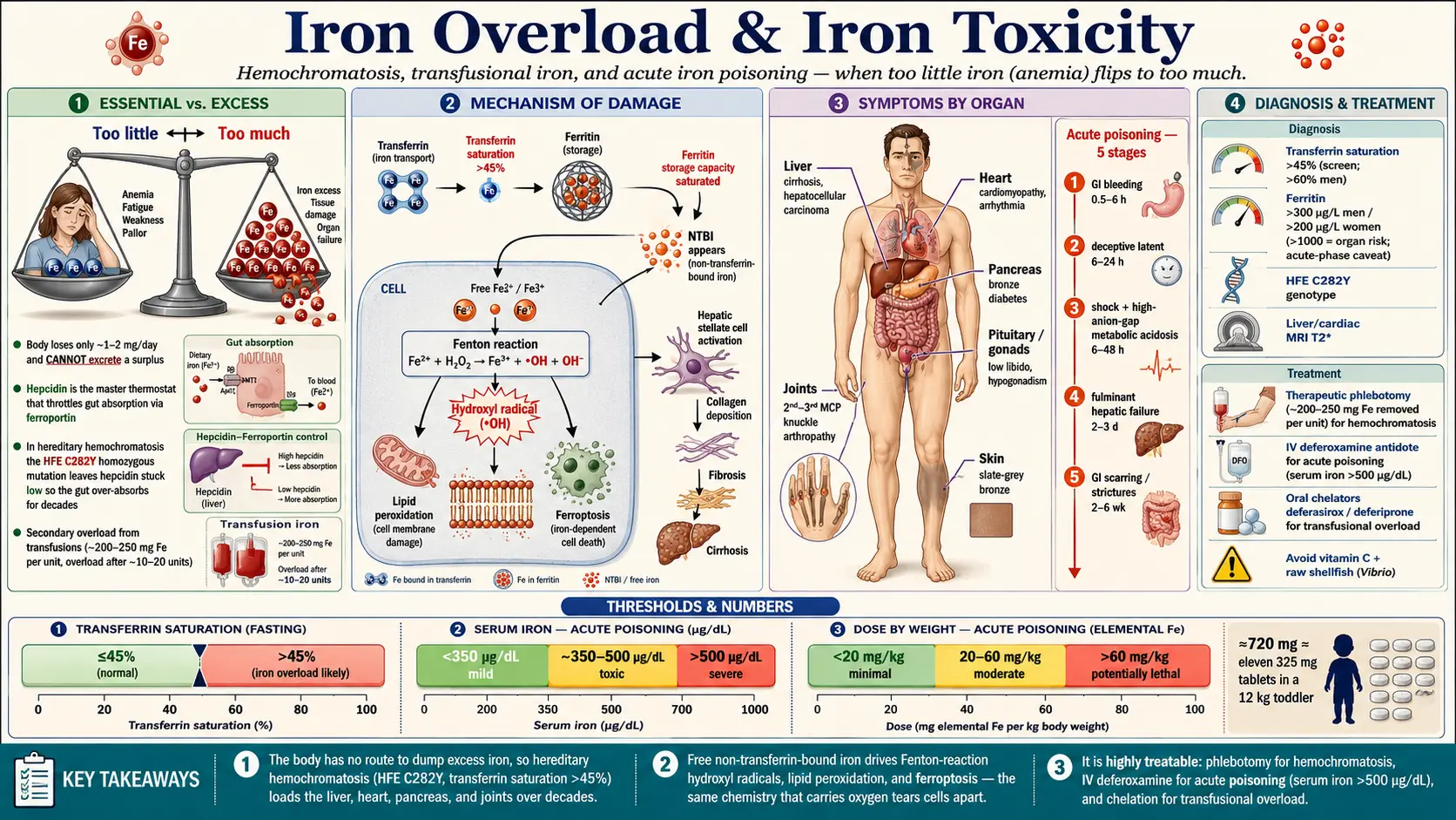 Iron Overload — scientific infographic poster